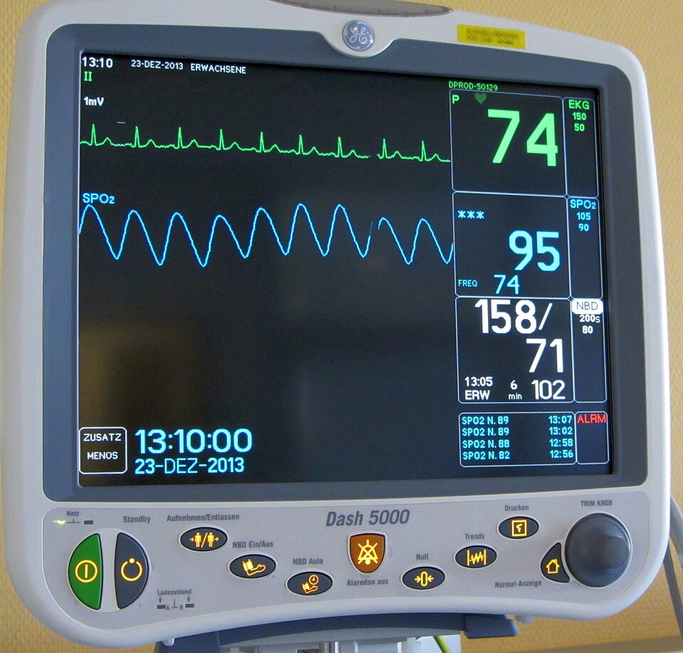 Patient Monitor